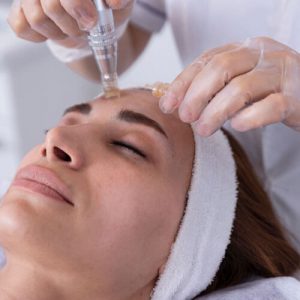 micro skin treatment